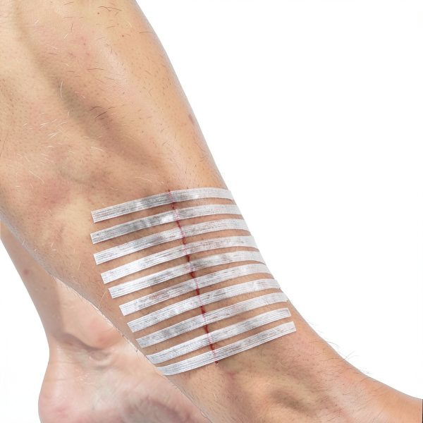 Steri-Strip Closure Reinforced Skin Strip .5 x 2" 3M Adhesive 50 Ct-4